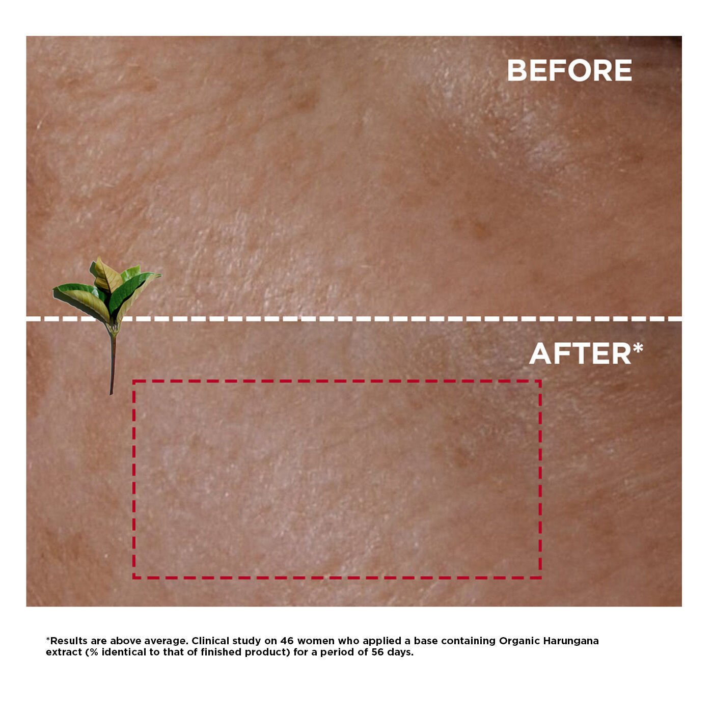 Clarins Super Restorative Day Cream - All Skin Types 50ml