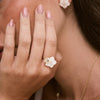 Danon Ring